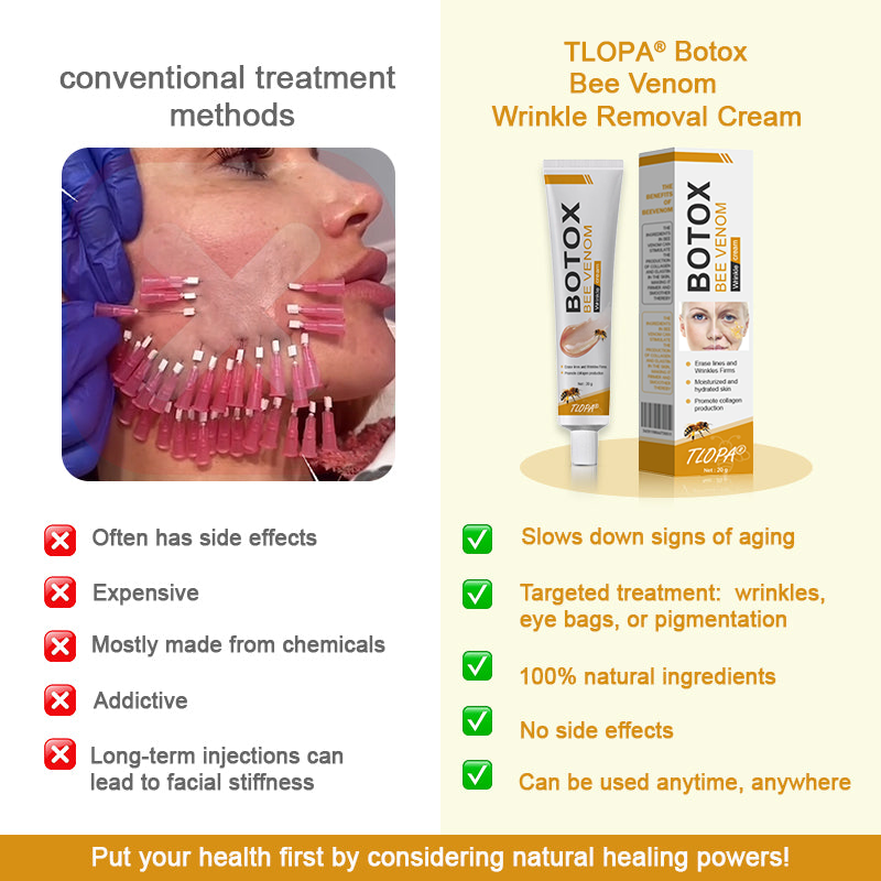 Made and dispatched in the UKโจ ๐ง๐๐ข๐ฃ๐ยฎ Botox Bee Venom Wrinkle Removal Cream๐จโโ๏ธ๐๐๐๐ ๐๐๐๐จ๐ฆ๐ฆ๐๐ง๐๐๐โจLAST DAY 80% OFF