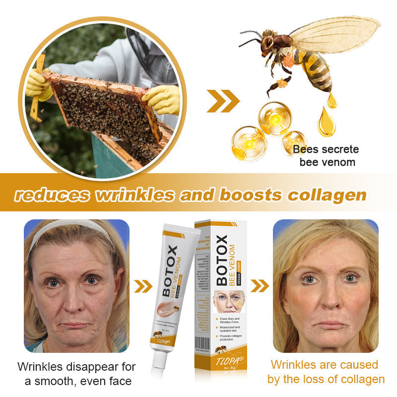 Made and dispatched in the UKโจ ๐ง๐๐ข๐ฃ๐ยฎ Botox Bee Venom Wrinkle Removal Cream๐จโโ๏ธ๐๐๐๐ ๐๐๐๐จ๐ฆ๐ฆ๐๐ง๐๐๐โจLAST DAY 80% OFF