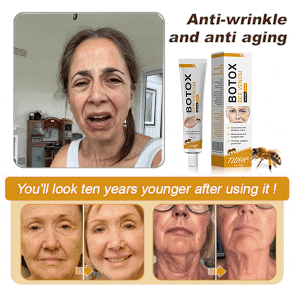 Made and dispatched in the UKโจ ๐ง๐๐ข๐ฃ๐ยฎ Botox Bee Venom Wrinkle Removal Cream๐จโโ๏ธ๐๐๐๐ ๐๐๐๐จ๐ฆ๐ฆ๐๐ง๐๐๐โจLAST DAY 80% OFF