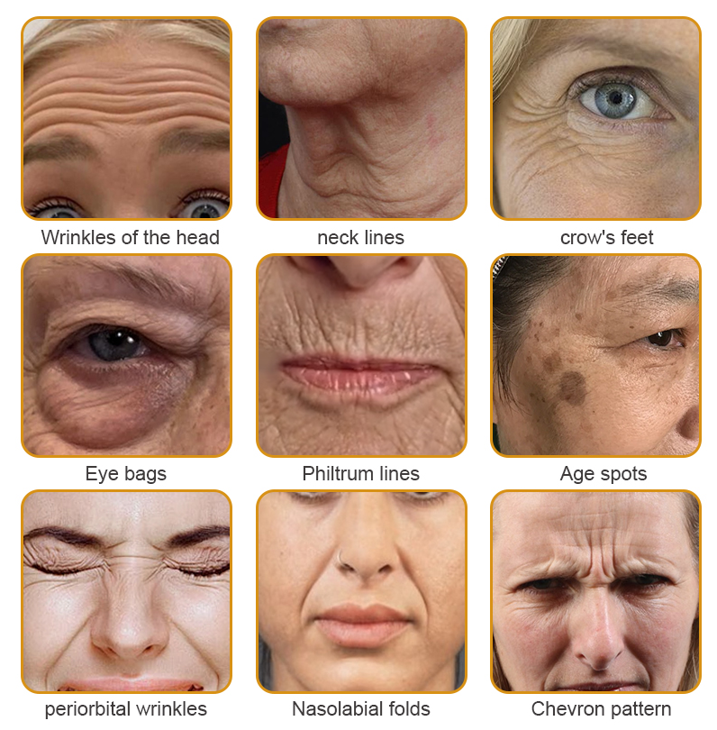 Made and dispatched in the UKโจ ๐ง๐๐ข๐ฃ๐ยฎ Botox Bee Venom Wrinkle Removal Cream๐จโโ๏ธ๐๐๐๐ ๐๐๐๐จ๐ฆ๐ฆ๐๐ง๐๐๐โจLAST DAY 80% OFF