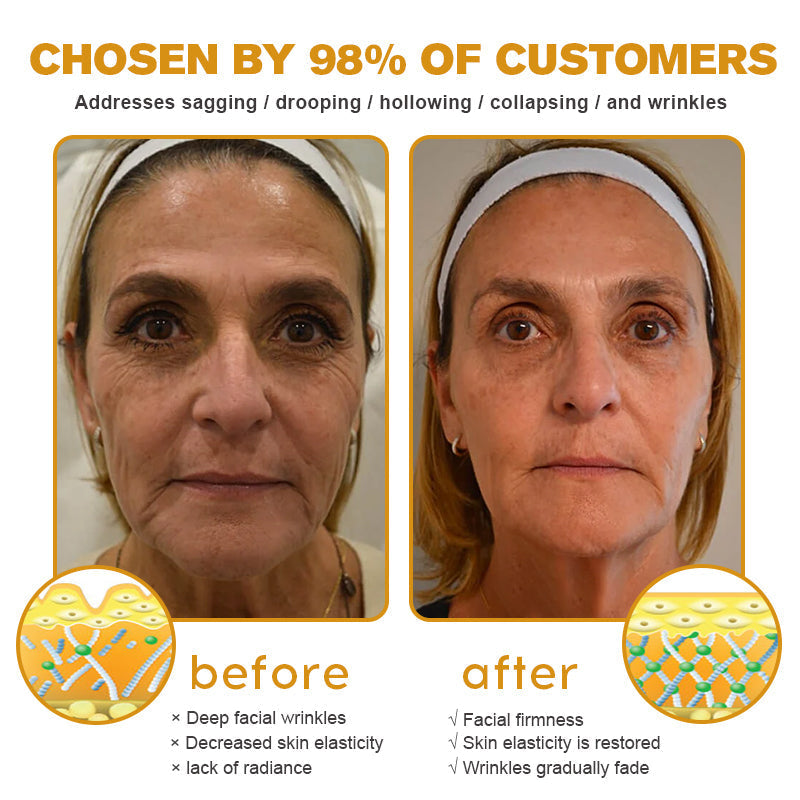 Made and dispatched in the UKโจ ๐ง๐๐ข๐ฃ๐ยฎ Botox Bee Venom Wrinkle Removal Cream๐จโโ๏ธ๐๐๐๐ ๐๐๐๐จ๐ฆ๐ฆ๐๐ง๐๐๐โจLAST DAY 80% OFF